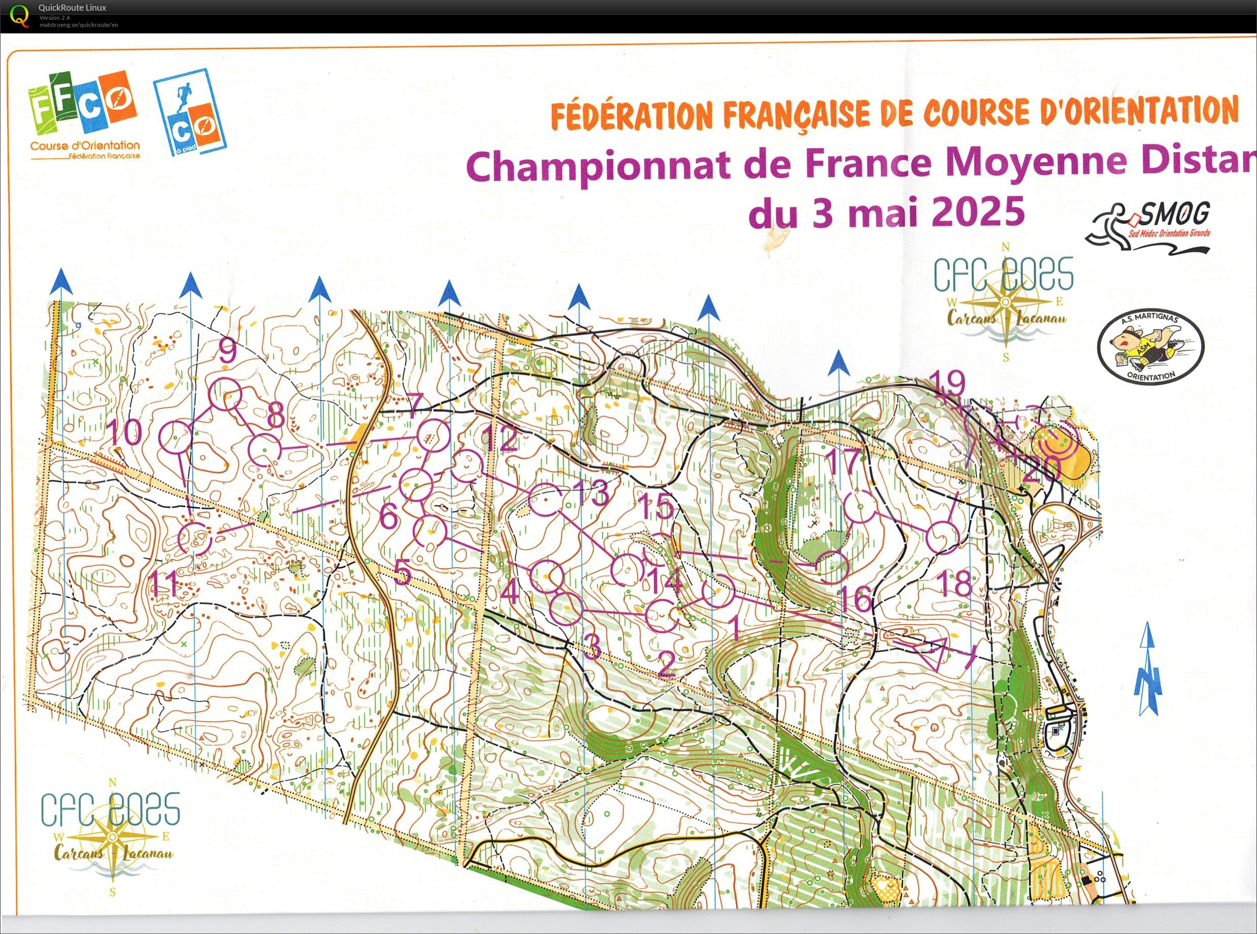 Chpt de Fr MD (03-05-2025)