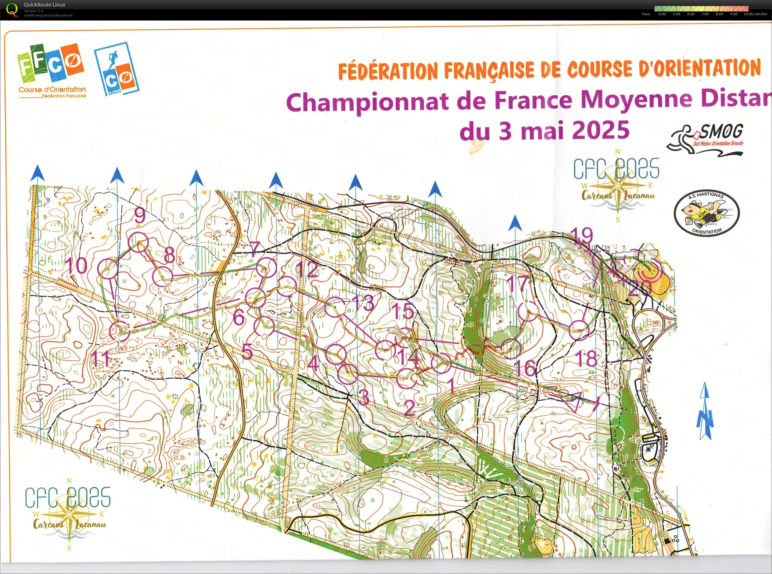 Chpt de Fr MD (03-05-2025)